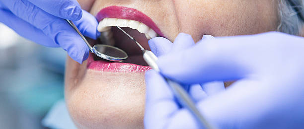 Best Emergency Gum Treatment in Pine Ridge, SD